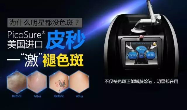 皮秒的優(yōu)勢(shì)是什么？
